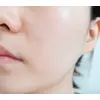 Заспокійлива ампульна сироватка з центелою Needly Cicachid Soothing Ampoule 30 мл Зображення