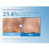 Гидрофильное масло для глубокой очистки пор Medicube Zero Pore Blackhead Deep Cleansing Oil 205 мл Изображение