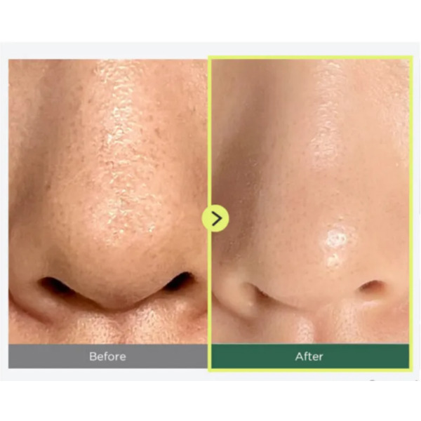 Гідрофільна олія для глибокого очищення пор Anua Heartleaf Pore Control Cleansing Oil тревел 20 мл Зображення