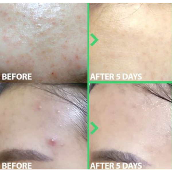 Успокаивающая сплэш-маска для проблемной кожи Blithe Soothing&Healing Green Tea Splash Mask 150 мл Изображение