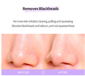 Гидрофильное масло от черных точек Celimax Derma Nature Fresh Blackhead Jojoba Cleansing Oil 150 мл Изображение