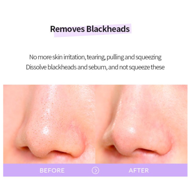 Гідрофільна олія від чорних цяток Celimax Derma Nature Fresh Blackhead Jojoba Cleansing Oil тревел 20 мл Зображення