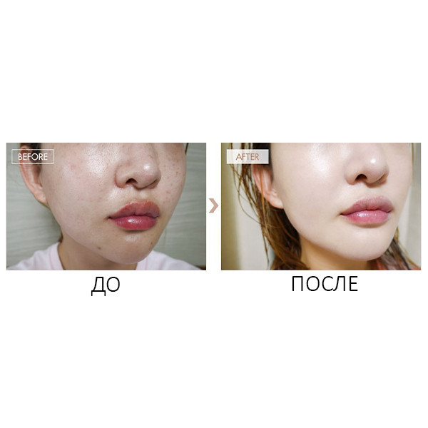 BB крем-бальзам с матирующим эффектом для лица Dr.Ceuracle Recovery BB Balm SPf 28 PA++ 45 мл Изображение